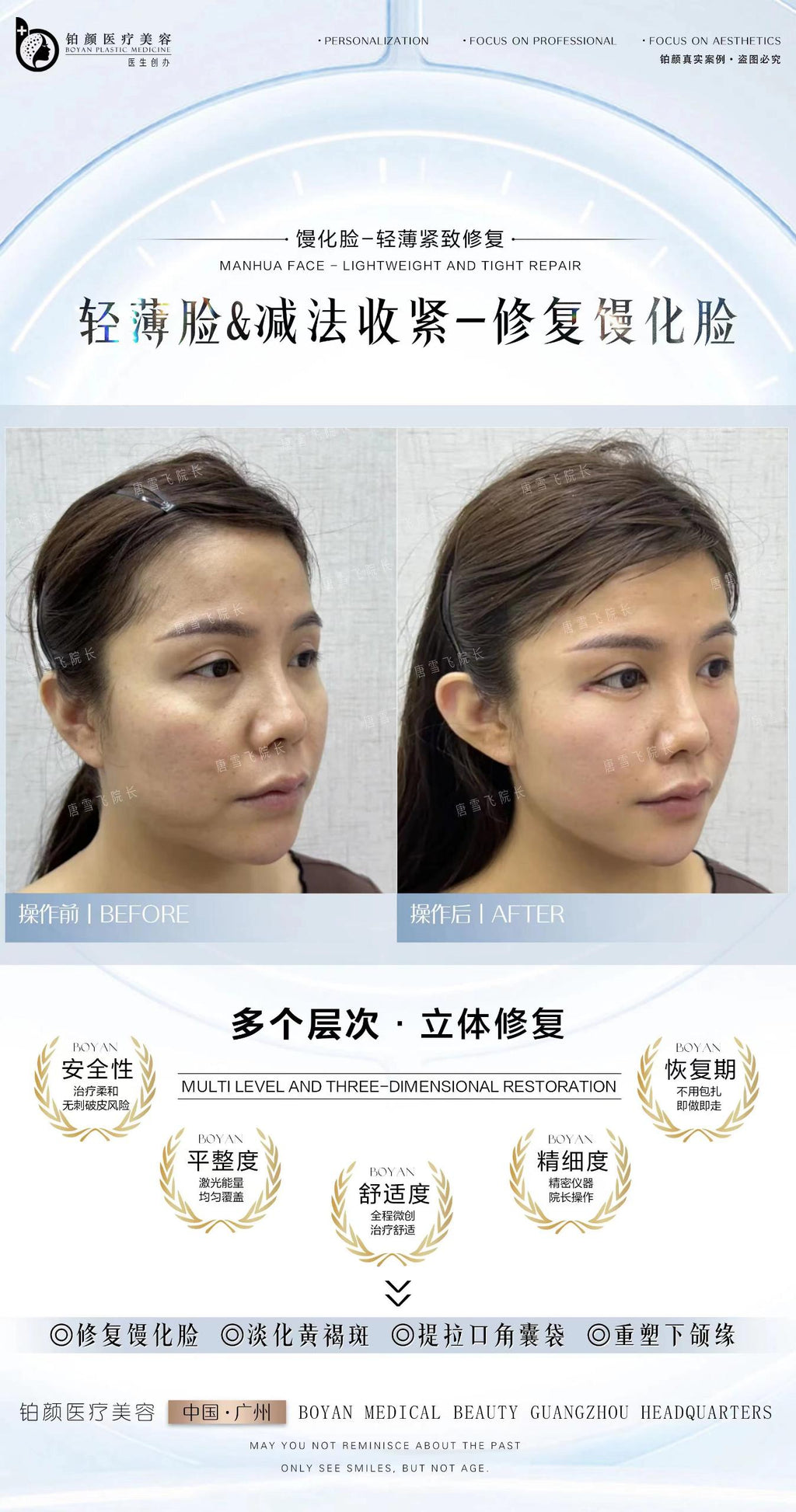 馒化修复