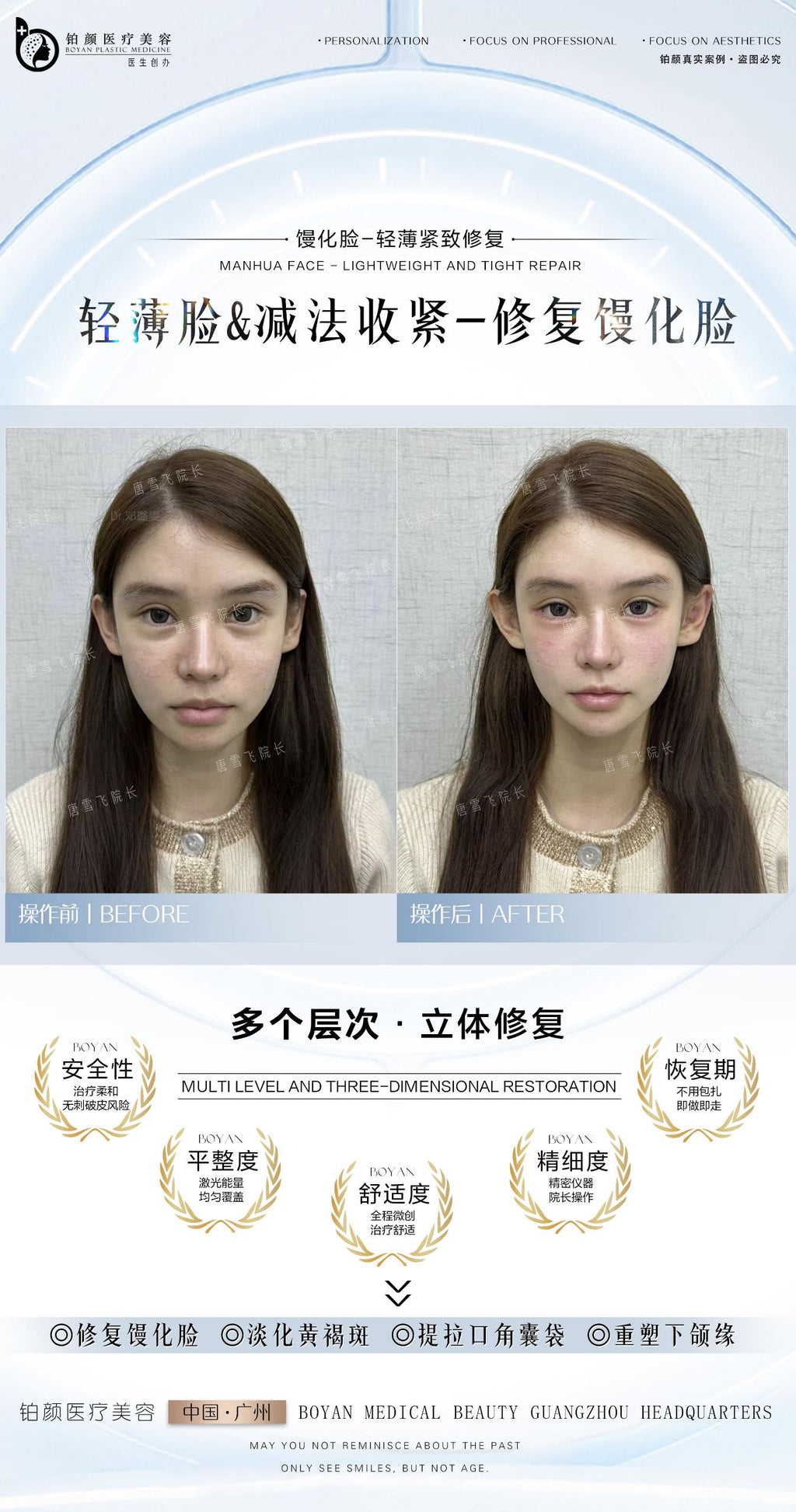 馒化修复