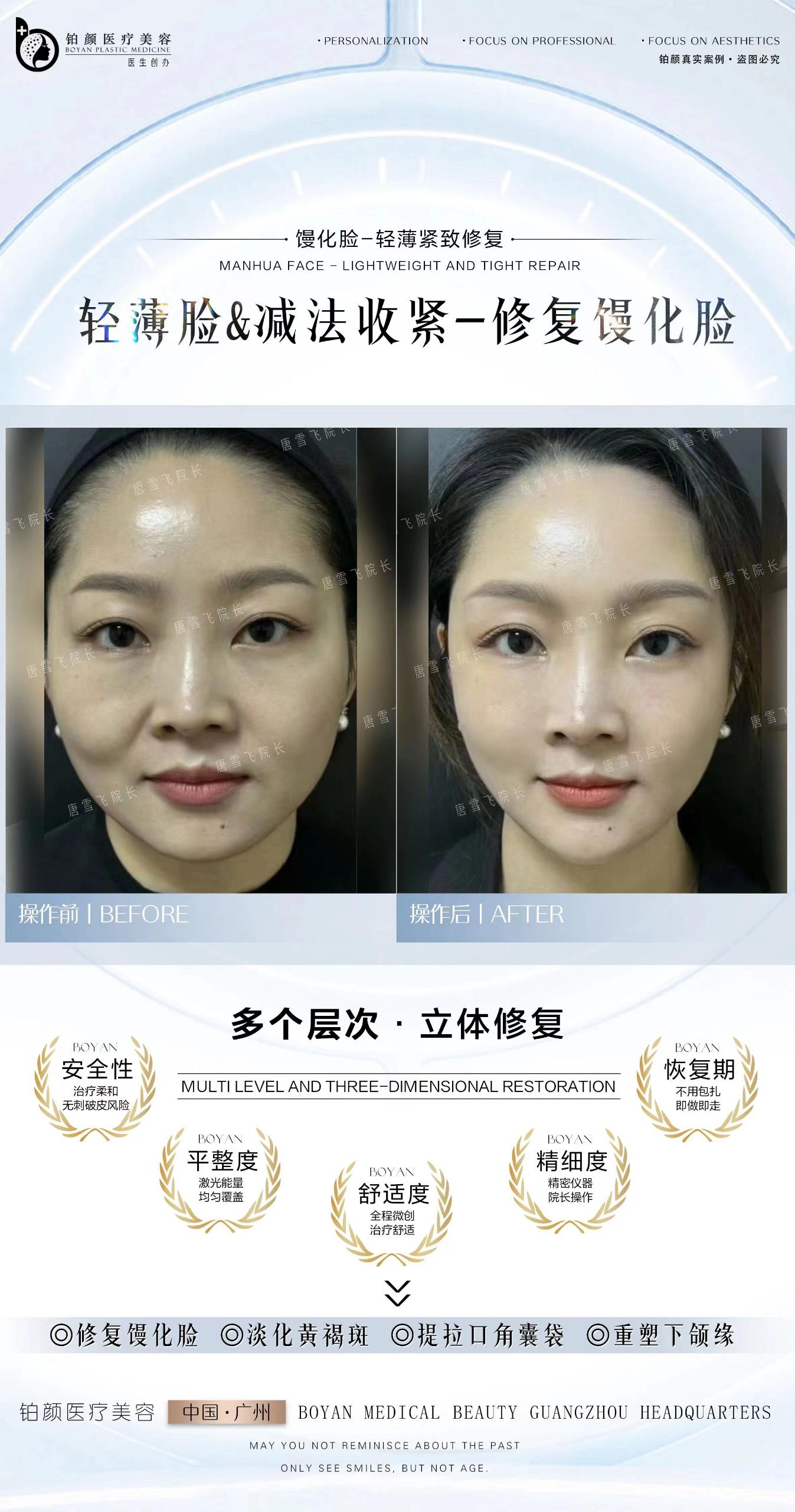 馒化修复