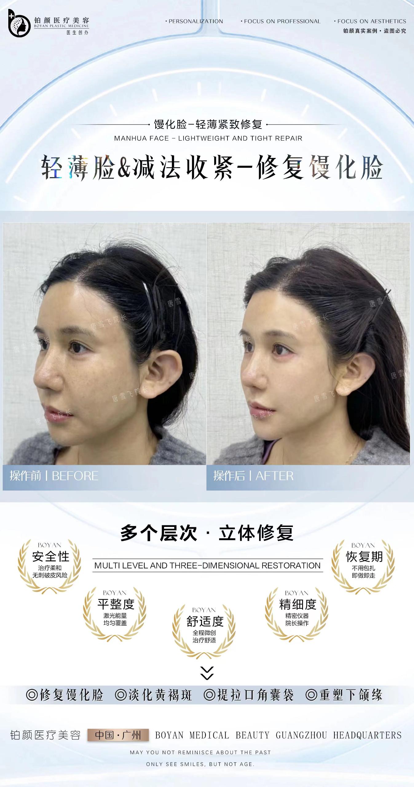 馒化修复