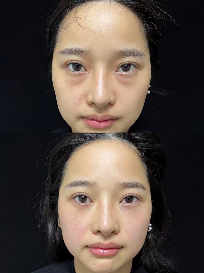 Deer Eyes Prabedah