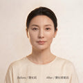 Non-Invasive Facial “Puffy Face” Correction Device | Facial Contour Remodeling System（馒化修复）