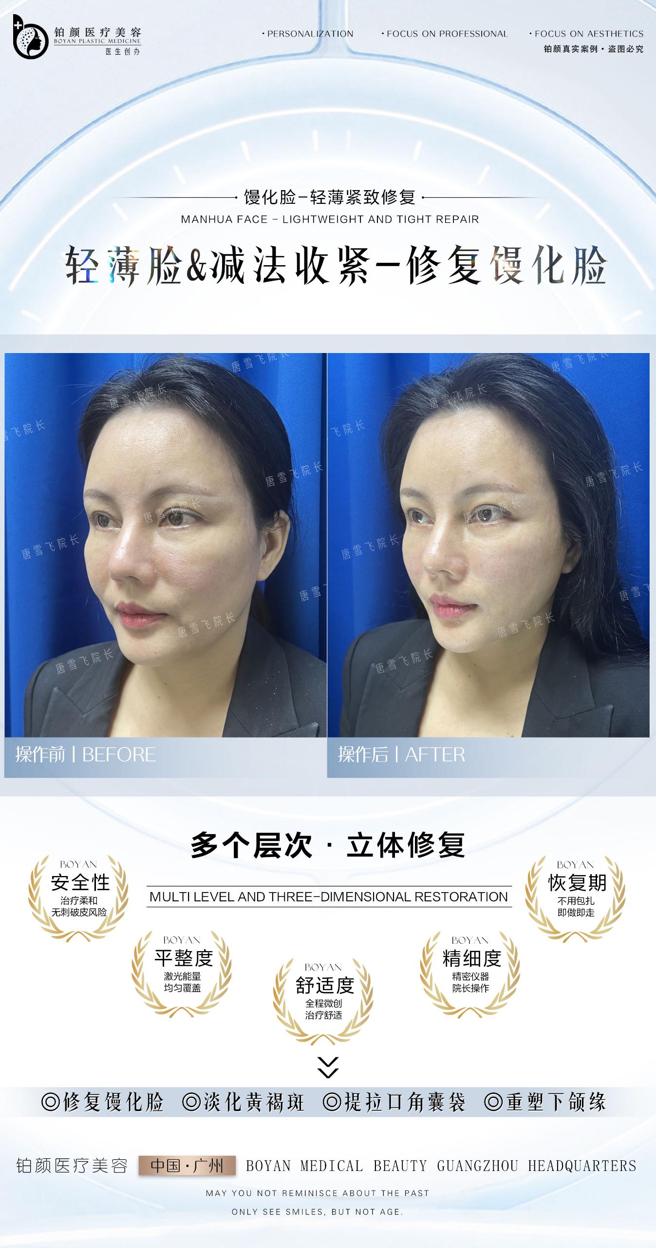 馒化修复